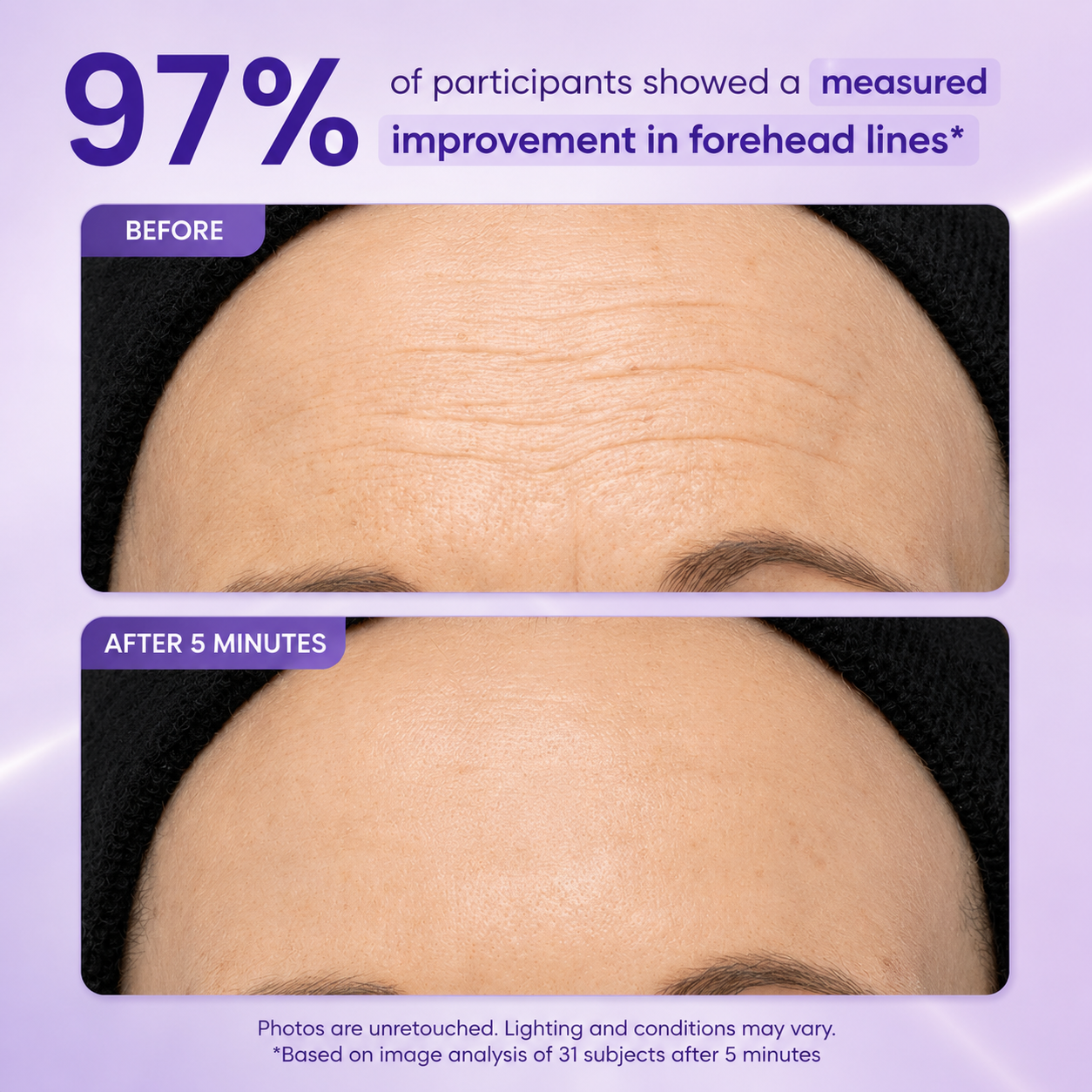 Instant Lift Eye Gel