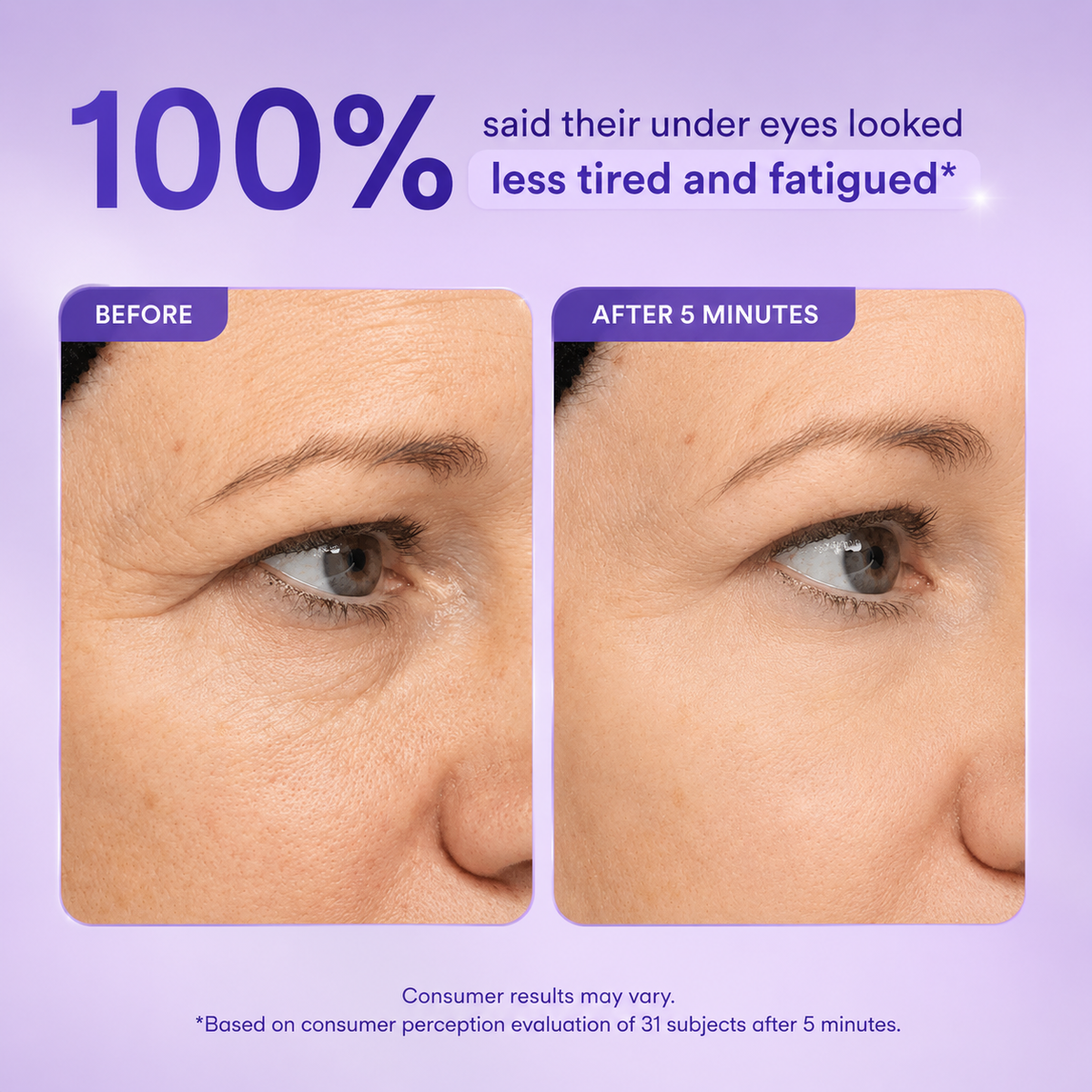 Instant Lift Eye Gel