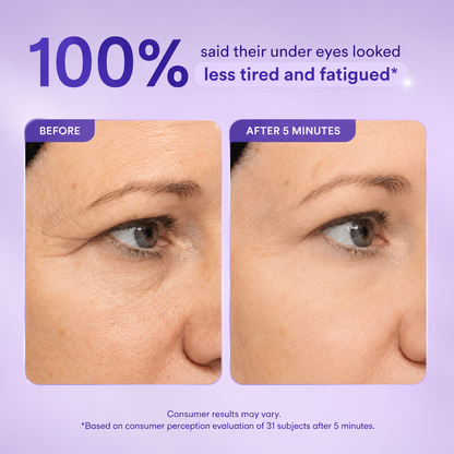 Instant Lift Eye Gel
